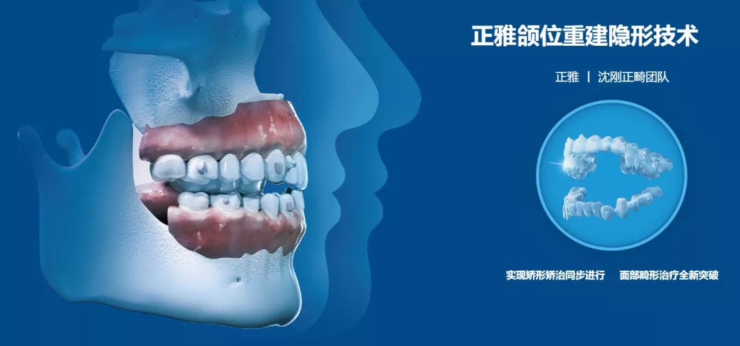 29371652927115_.pic.jpg 29371652927115_.pic.jpg